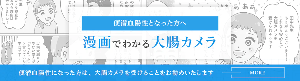 漫画でわかる大腸カメラ検査